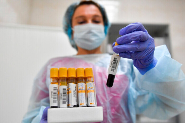 Ученые обнаружили новый вариант Covid-19, который их беспокоит