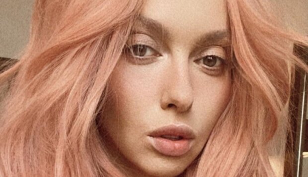 Оля Полякова помолодела на 10 лет и честно призналась, что сделала с собой: 